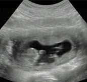 Haute 100 Update: Beyoncé Shows Sonogram Photo of Daughter Blue Ivy In HBO Documentary Trailer — VIDEO